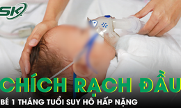 Bé 1 tháng tuổi suy hô hấp nặng vì đốt bấc và chích rạch đầu