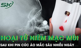 Bé trai 4 tuổi hoại tử niêm mạc mũi vì pin cúc áo mắc sâu nhiều ngày