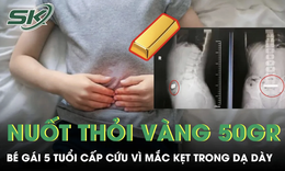 Bé gái 5 tuổi nuốt thỏi vàng 50 gram mắc kẹt trong dạ dày 