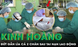 Người đàn ông 59 tuổi bị đứt gần lìa cả hai chân sau tai nạn