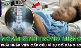 Ngậm đinh trong miệng, người đàn ông 50 tuổi phải nhập viện cấp cứu