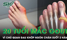 Đau khớp ngón chân suốt 2 năm nam thanh niên 20 tuổi mắc gout