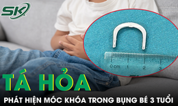 Tá hỏa phát hiện chiếc móc khóa hình chữ C trong bụng bé 3 tuổi