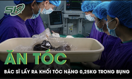 Bé gái ăn tóc nhiều năm, bác sĩ lấy ra khối tóc nặng 0,25 kg trong bụng