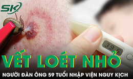 Chủ quan với vết loét không đau, người đàn ông nhập viện nguy kịch