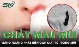 Chảy máu mũi suốt một tháng nam thanh niên phát hiện con đỉa trú trong mũi