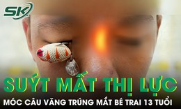 Móc câu văng trúng mắt, bé trai 13 tuổi suýt mất thị lực
