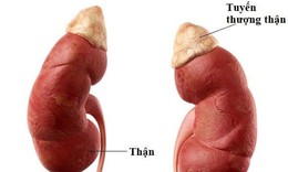 Nhận biết sớm dấu hiệu suy tuyến thượng thận ở trẻ
