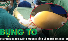 Bé gái 15 tuổi bụng to như tăng cân, phát hiện khối u buồng trứng khổng lồ