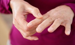 Run ở người trẻ có thể là dấu hiệu tổn thương thần kinh