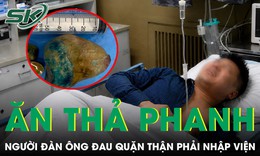 Vừa tán sỏi thận đã ăn mặn uống bia, người đàn ông đau quặn thận
