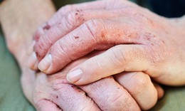 Sản phẩm được nhiều người viêm da cơ địa tin dùng
