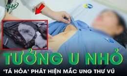 Tưởng chỉ là u nhỏ, người phụ nữ ‘tá hoả’ mắc ung thư vú