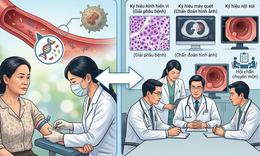 Xét nghiệm ctDNA có quyết định việc hóa trị sau mổ ung thư đại tràng?