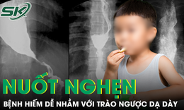 Nuốt nghẹn kéo dài, bé trai 10 tuổi mắc bệnh hiếm dễ bị nhầm với trào ngược dạ dày