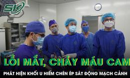 Lồi mắt, chảy máu cam, bé trai 14 tuổi phát hiện khối u hiếm chèn ép sát động mạch cảnh