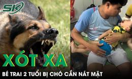 Chơi với đàn chó con, bé trai hơn 2 tuổi bị chó mẹ cắn nát vùng hàm mặt 