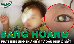 Bàng hoàng phát hiện trẻ mắc ung thư hiếm gặp từ dấu hiệu ở mắt