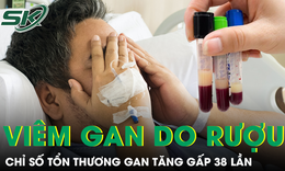 Uống rượu nhiều năm, người đàn ông có chỉ số tổn thương gan tăng gấp 38 lần