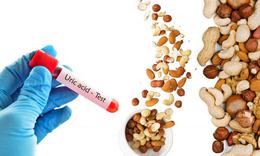 Tăng acid uric máu không chỉ do hải sản mà còn do nhiều thói quen 
