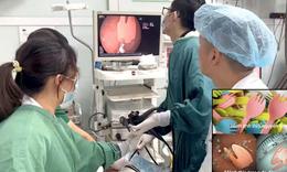 Cắn gãy thìa nhựa khi ăn sữa chua, bé 20 tháng tuổi phải nhập viện cấp cứu