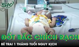 Tin mẹo dân gian, bé trai 1 tháng tuổi nguy kịch sau đốt bấc chích rạch chữa bệnh