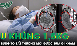 Người phụ nữ 42 tuổi mang khối u 1,5 kg trong ổ bụng mà không hay biết