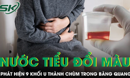 Nước tiểu chuyển màu, phát hiện 9 khối u thành chùm trong bàng quang