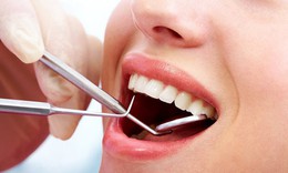 Những thói quen âm thầm làm hỏng răng