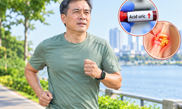 Nam giới sau 50 tuổi có acid uric cao chạy bộ cường độ nào là phù hợp?