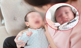 Bé 12 tháng tuổi tím tái khi bú, bác sĩ lưu ý thói quen gây hại