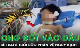 Chỉ vài phút sau khi bị ong đốt vào đầu, bé trai 8 tuổi sốc phản vệ