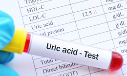 7 lưu ý khi tầm soát acid uric