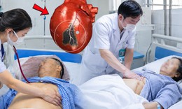 Cứu sống thành công hai vợ chồng bị nhồi máu cơ tim nguy kịch