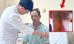 Ngã võng sau cuộc nhậu, người đàn ông 43 tuổi gãy đốt sống cổ