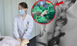 Bác sĩ kể khoảnh khắc sinh tử cứu thai nhi dây rốn xoắn tới 40 vòng
