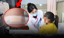 Bé gái sốt cao 2 ngày, thủ phạm dưới băng cá nhân ở gót chân