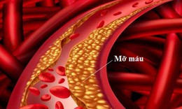 5 lưu ý khi điều trị mỡ máu tại nhà
