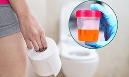 Không chủ quan khi tiểu ra máu
