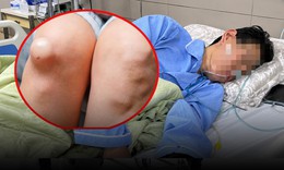 Người đàn ông phát hiện ung thư từ một dấu hiệu bất thường ở chân 