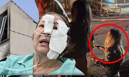 Thoát khỏi biển lửa, người phụ nữ bất lực nhìn mẹ già và con dâu tử vong