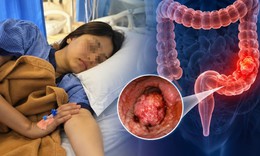 Nữ sinh mới 15 tuổi đã qua đời vì ung thư đại trực tràng giai đoạn cuối
