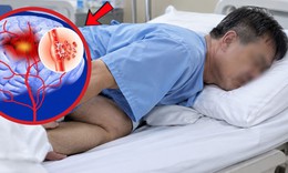 Đang ngủ bất ngờ đột quỵ, người đàn ông thoát chết nhờ biết điều này
