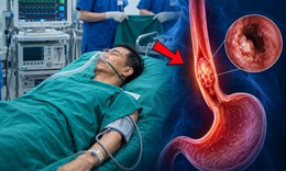 Làm 3 việc này suốt 30 năm, người đàn ông phát hiện mắc ung thư thực quản