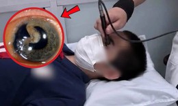 Bạn bật ô che mưa, nam sinh bị vỡ nhãn cầu có thể mù vĩnh viễn