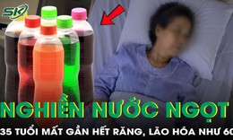 Nghiền nước ngọt, người phụ nữ 35 tuổi mất gần hết răng, lão hóa như 60