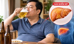 Gan nhiễm mỡ đang trẻ hóa, ai có nguy cơ?