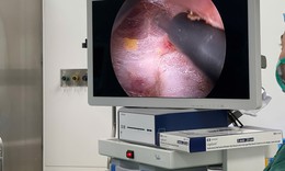 Phẫu thuật nội soi tuyến giáp – thêm lựa chọn cho bệnh nhân tại BV Bạch Mai cơ sở Ninh Bình