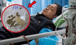 Người đàn ông suy gan vì tự uống thuốc chữa xơ gan, vàng da gấp 42 lần