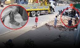 Cổng làng sập đè bé trai lớp 3, bác sĩ nối tạm bàn tay vào mạch máu cẳng chân